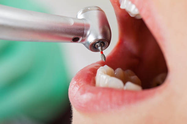 Best Emergency Dental Services for Seniors in Heath, OH